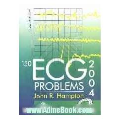 150 ECG problems