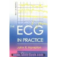 The ECG in practice