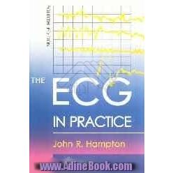 The ECG in practice