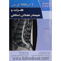 CT و MRI کل بدن فقرات و سیستم عضلانی اسکلتی