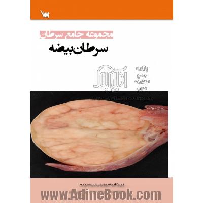 مجموعه جامع سرطان: سرطان بیضه