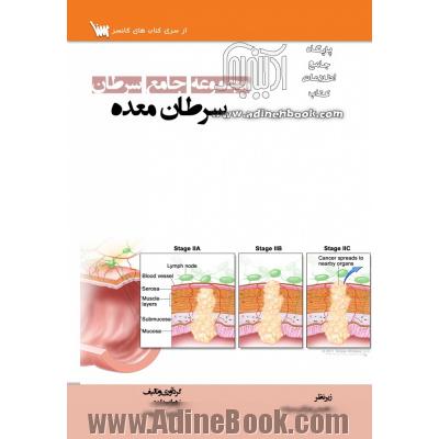 مجموعه جامع سرطان: سرطان معده