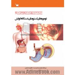 مجموعه جامع سرطان تومورهای استرومای و دستگاه گوارش