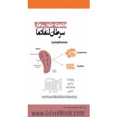 مجموعه جامع سرطان: سرطان لنفادما (ادم لنفاوی)