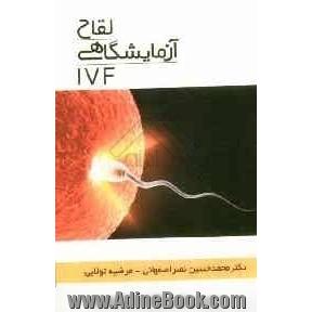 لقاح آزمایشگاهی (IVF)