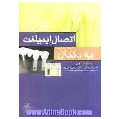 اتصال ایمپلنت به دندان: مفاهیم بنیادی و پروسه کلینیکی