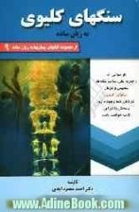 سنگ های کلیوی به زبان ساده: هر سوالی که راجع به علل، علائم و نشانه ها، تشخیص و درمان سنگهای کلیوی در ذهن شما وجود دارد پاسخش را در این کتاب خوا