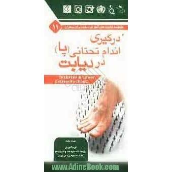 درگیری اندام تحتانی (پاها) در دیابت