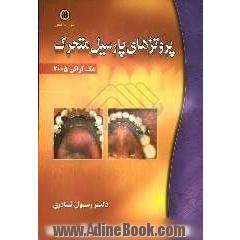 پروتزهای پارسیل متحرک (مک کراکن) 2005