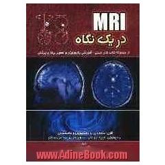 MRI در یک نگاه (از مجموعه کتاب های تستی - آموزشی رادیولوژی و تصویربرداری پزشکی) ...