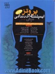 پروتز ایمپلنت های دندانی (میش 2005)