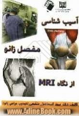 آسیب شناسی زانو از نگاه MRI