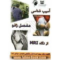 آسیب شناسی زانو از نگاه MRI